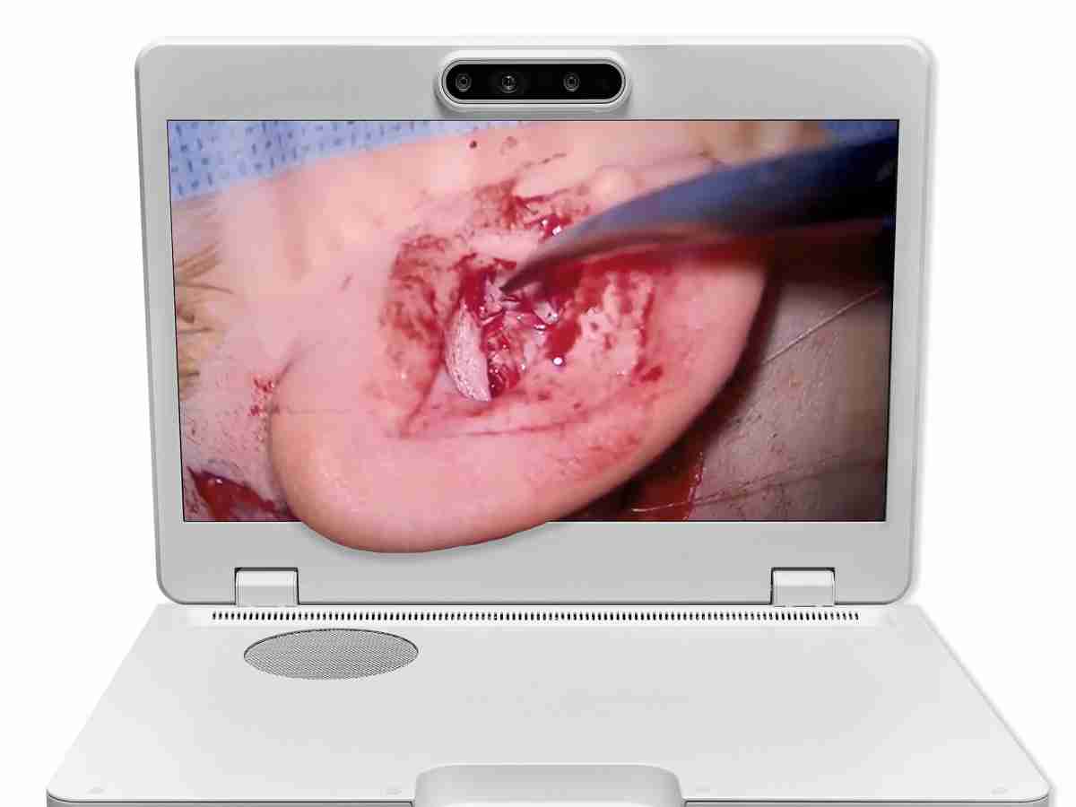 达擎之＂Heads-up 3D显微手术显示系统＂，，整合4K裸眼3D显示及眼球追踪系统，，，具备快速追踪人眼移动位置功能，，减轻医师长时间维持固定姿势的负担，，让医师能有更宽广清晰的3D立体视野及更舒适的姿势来执行手术。。。